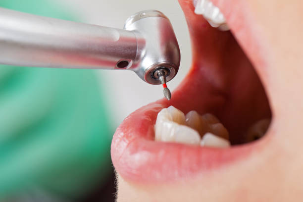 Best Cosmetic Emergency Dentistry in Hollister, CA